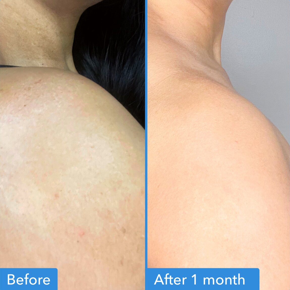 discoloration-correcting-body-treatment-e2 zb_p.jpg