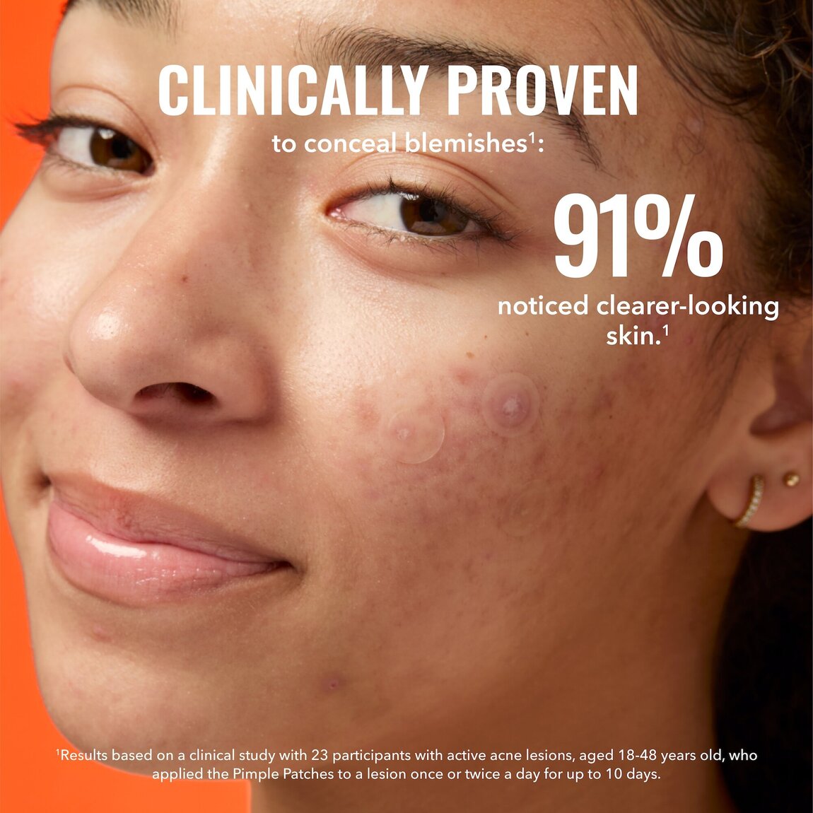 pimple-patches-y2 zb_p.jpg