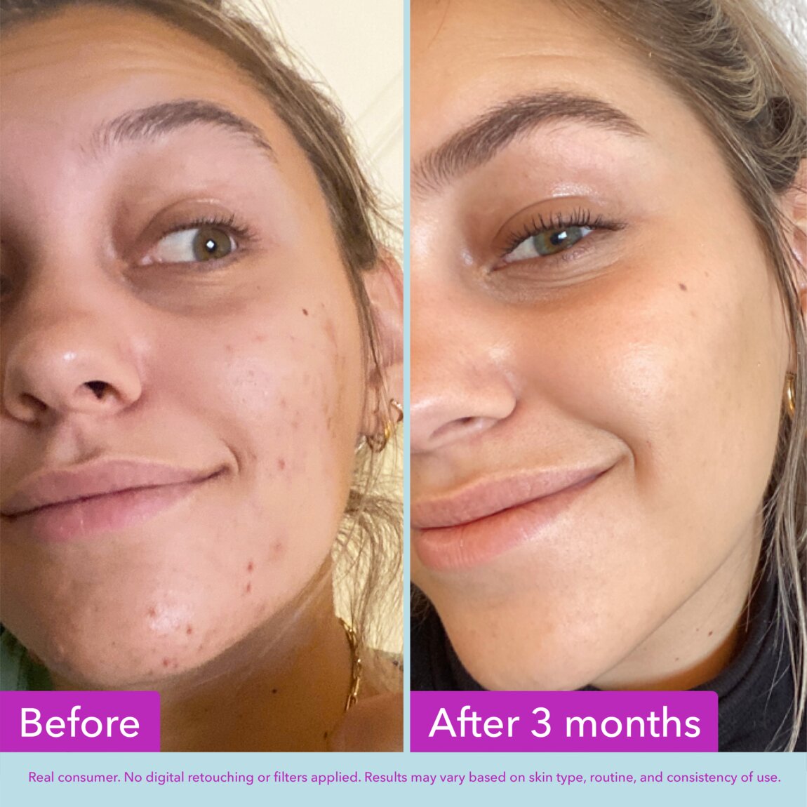 niacinamide-brightening-toner-n0 zb_p.jpg