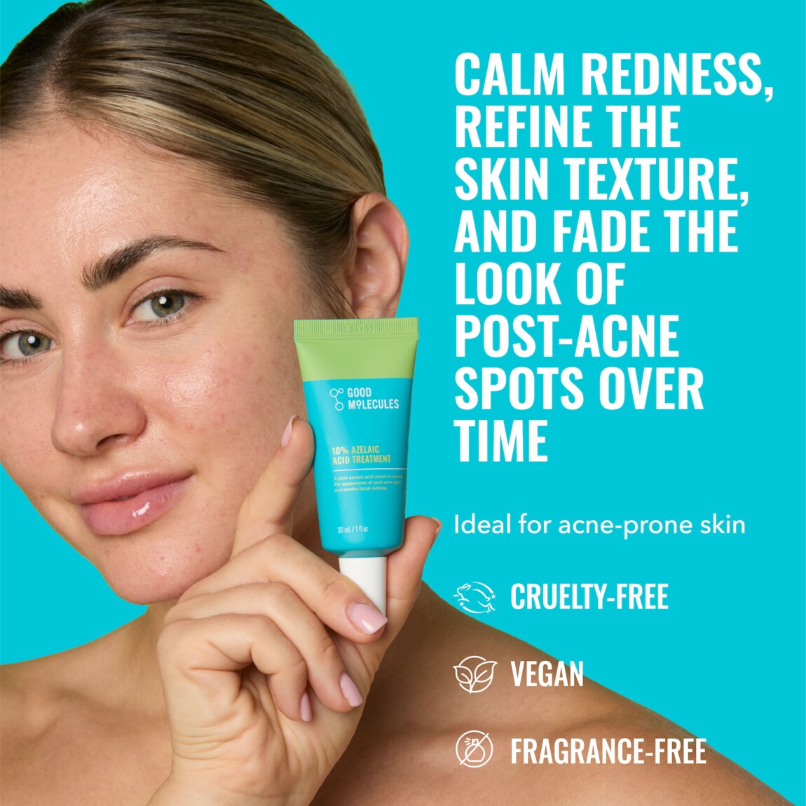 10-azelaic-acid-treatment-o8 zb_p.jpg